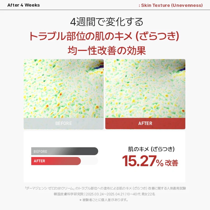 『27％限定クーポンあり』カン・ダニエルお得コラボ3点セット！　#ニキビ#毛穴#トラブル肌#皮脂バランス整える＃野バラの花水81％#皮脂バランス整える＃敏感肌でも使える