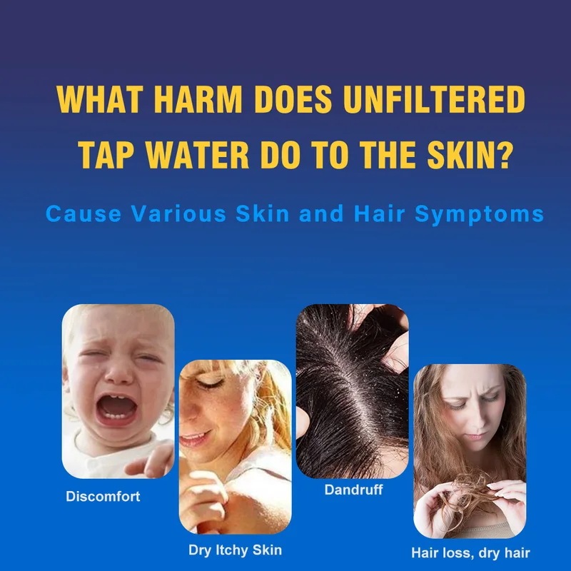 AlthyビタミンC活性化シャワー水フィルター-塩素化の強力な金属を削減-乾燥させた肌を改善しヘアダンドラフeczema