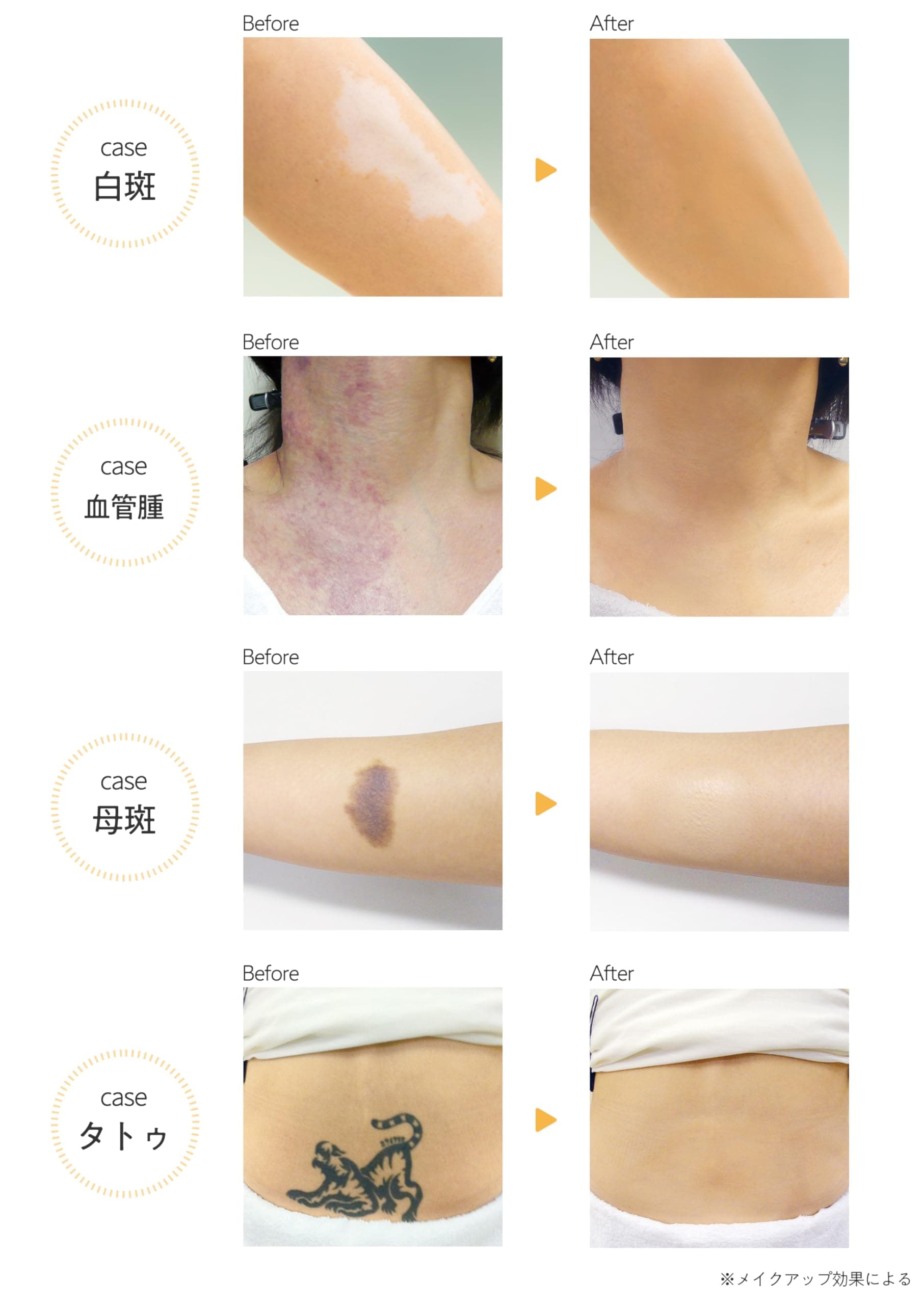 マーシュフィールド SC ボディカバーファンデN (01 40グラム (x 1)) マーシュフィールド SC ボディカバーファンデN (01 40グラム (x 1))