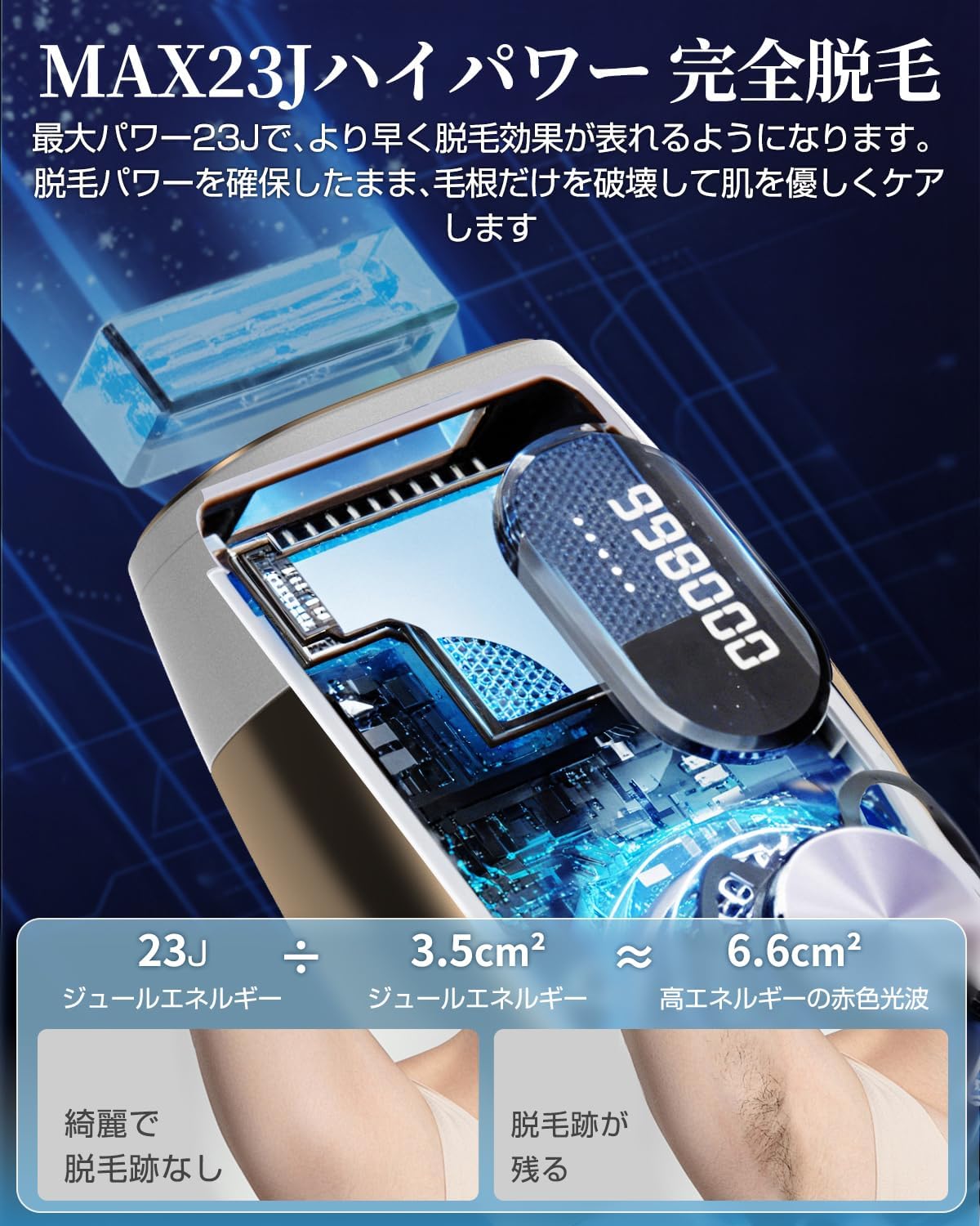 脱毛器 【2025夏新モデル サロン級HIPL光】 冷感 サファイア冷却技術 約