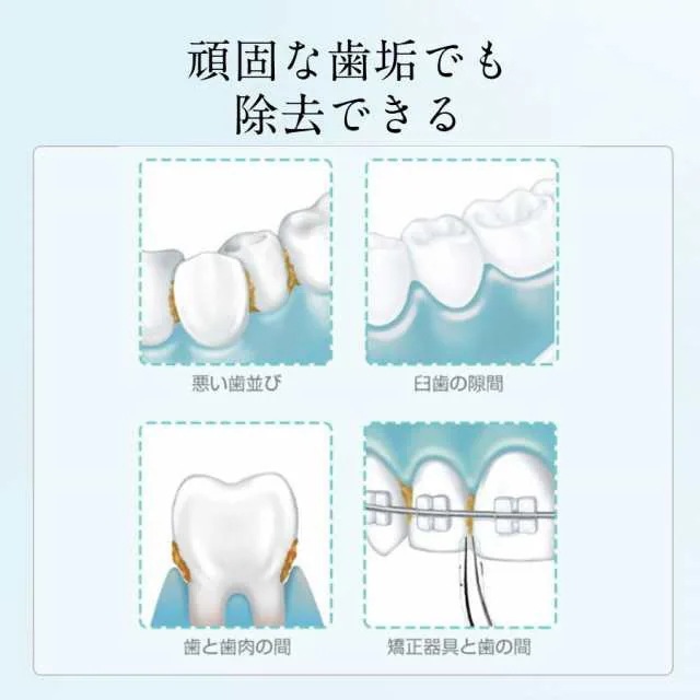 口腔洗浄器 ジェットウォッシャー ウォーターフロス 歯ブラシ USB充電式 IPX7防水 水流洗浄 強弱切り替え 舌磨きノズル 噴射 歯石 携帯型 口腔洗浄器 ジェットウォッシャー ウォーターフロス 歯ブラシ USB充電式 IPX7防水 水流洗浄 強弱切り替え 舌磨きノズル 噴射 歯石 携帯型