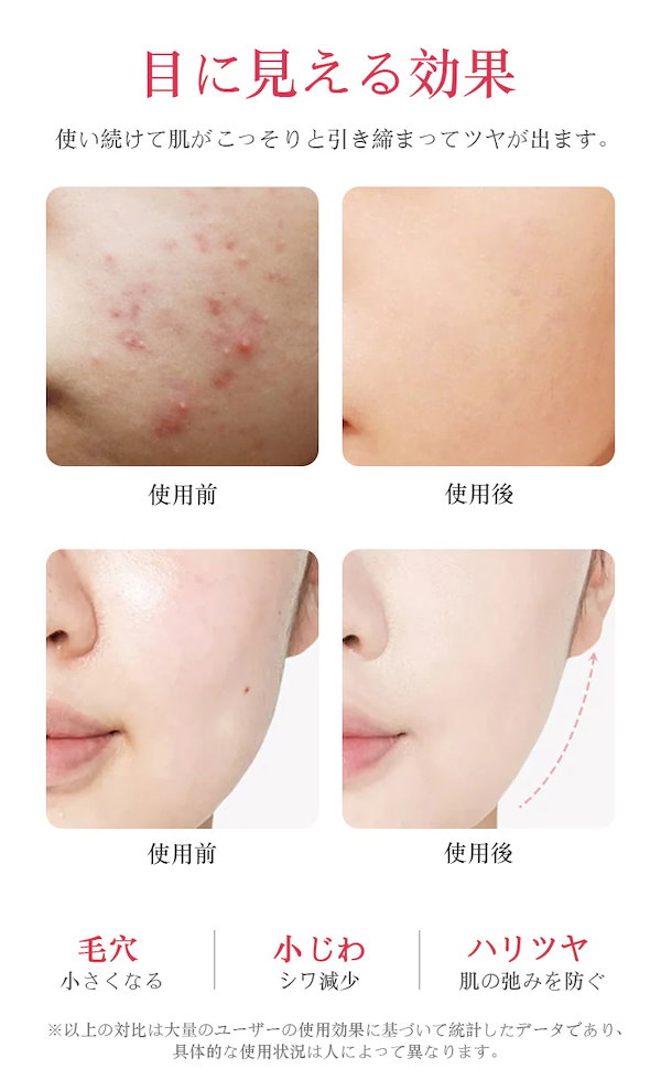 ELFACE 美顔器 ems リフトアップ効果 楽天市場】＼ポイント20倍／ エルフェイス ELFACE 美顔器 リフトアップ