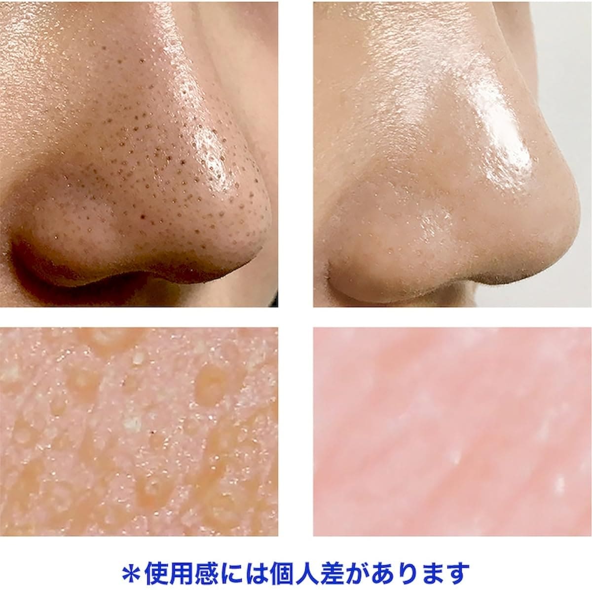 ワンデイズユー ノーモアブラックヘッド 簡単角質ケア 削る必要のない優しいノーズピーリング 100ml 【2個セット】 agenciaidee.com