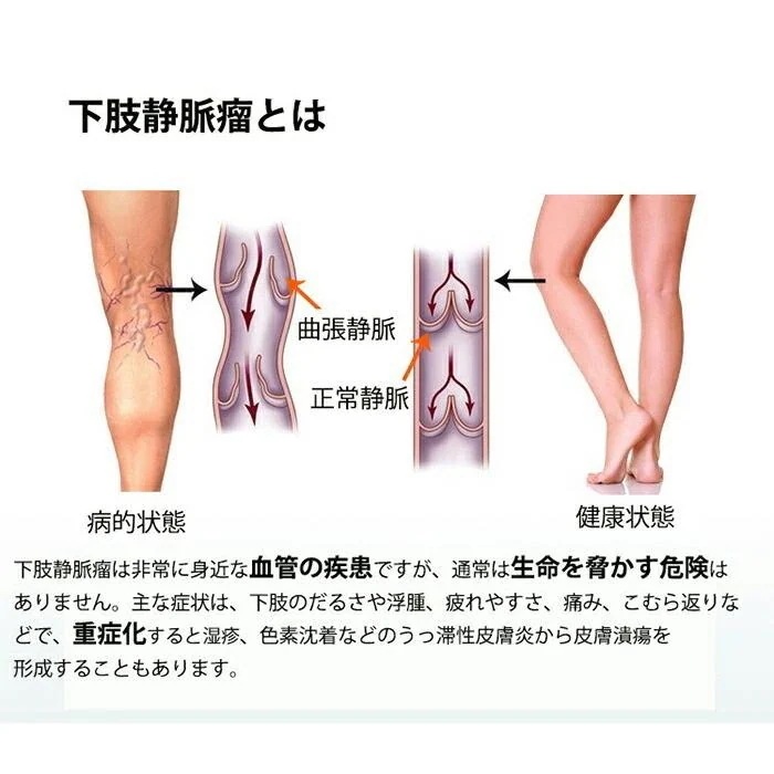 メガ割 弾性ストッキング 医療用 むくみ予防 下肢静脈瘤ストッキング ボディシェイプスパッツ 骨盤サポート骨盤矯正 着圧レギンス冷え対策 レディース メガ割 弾性ストッキング 医療用 むくみ予防 下肢静脈瘤ストッキング ボディシェイプスパッツ 骨盤サポート骨盤矯正 着圧レギンス冷え対策 レディース