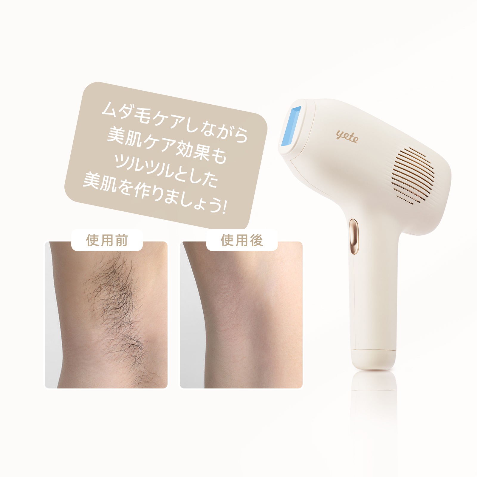 新品未開封 beautigo 家庭用脱毛器 BEG-630 ピンク 新品未開封 beautigo 家庭用脱毛器 BEG-630 ピンク - メルカリ