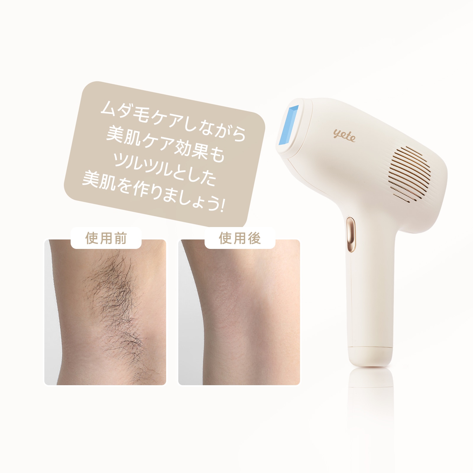 Qoo10] yete Beautigo 脱毛器 永久脱毛 無痛