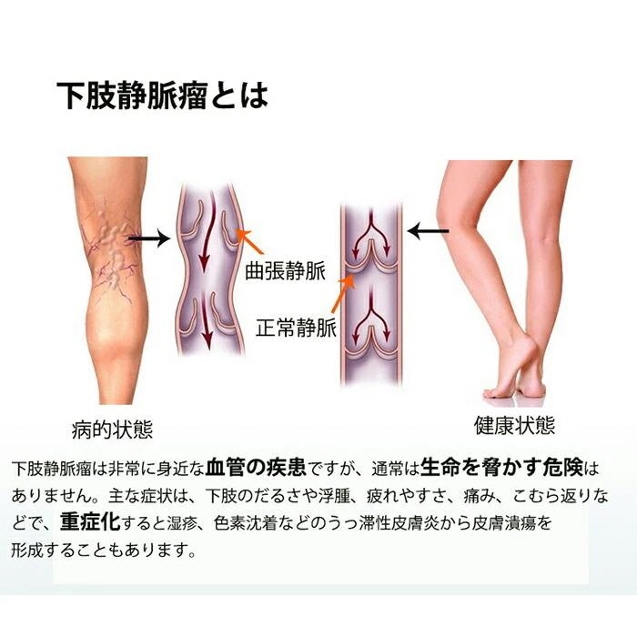 【1つ買うと1つ無料】【メガ割 】弾性ストッキング 医療用 むくみ予防 下肢静脈瘤ストッキング ボディシェイプスパッツ 骨盤サポート骨盤矯正 着圧レギンス冷え対策 レディース 【1つ買うと1つ無料】【メガ割 】弾性ストッキング 医療用 むくみ予防 下肢静脈瘤ストッキング ボディシェイプスパッツ 骨盤サポート骨盤矯正 着圧レギンス冷え対策 レディース