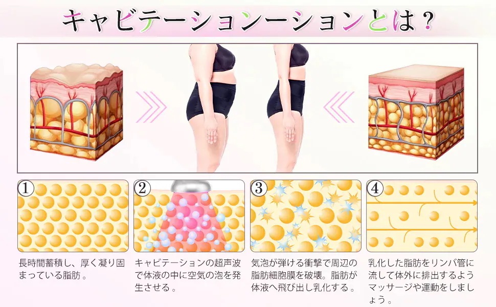 キャビテーション 家庭用 超音波美顔器 セルライト除去 振動マッサージ RFラジオ波 高周波 キャビスタイル LED光エステ 脂肪燃焼 全身ダイエット痩身 フェイスケア リフトアップ 自宅エステ キャビテーション 家庭用 超音波美顔器 セルライト除去 振動マッサージ RFラジオ波 高周波 キャビスタイル LED光エステ 脂肪燃焼 全身ダイエット痩身 フェイスケア リフトアップ 自宅エステ