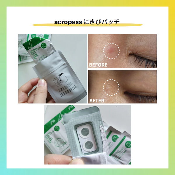 ACROPASS RETINOL ビマトプロスト アプリケーター 2点セット ACROPASS RETINOL ビマトプロスト アプリケーター 2点セット