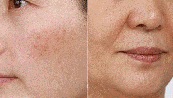 Qoo10] Elujai 【1+1】 コラーゲンリンクルバーム 1