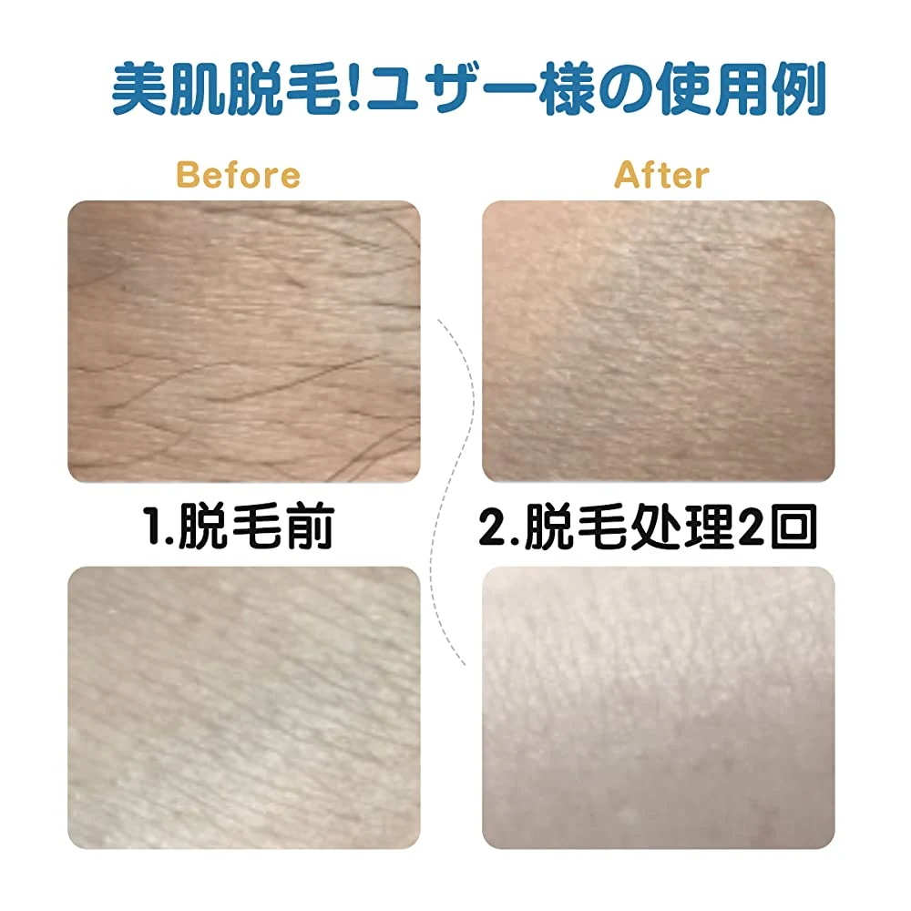 脱毛器 レーザー脱毛 髭脱毛 光美容器 冷感脱毛 IPL技術 フラッシュ式 VIO対応 美肌機能搭載