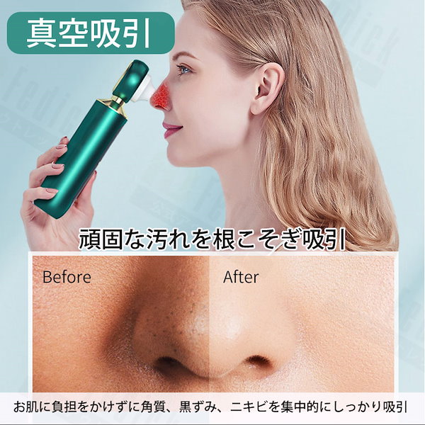 Qoo10] JOPSYKAL 【2021最新拡大鏡版】毛穴吸引器 毛穴