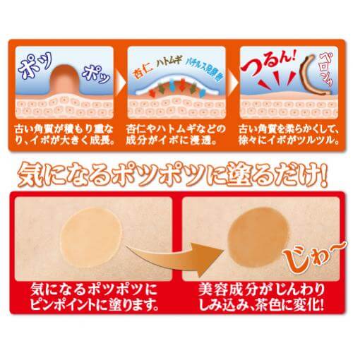 イポロン P 20g 2個セット イポロン P 20g 2個セット