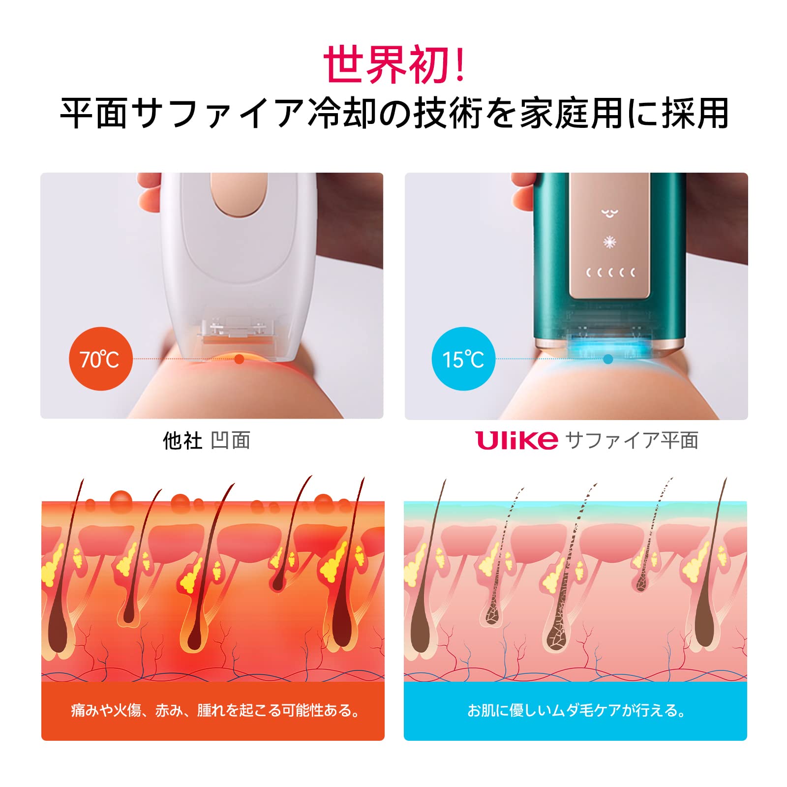 Ulike ユーライク 脱毛器 Air Pro メンズ レディース VIO対応 髭対応 ダークグリーン UI04CJP