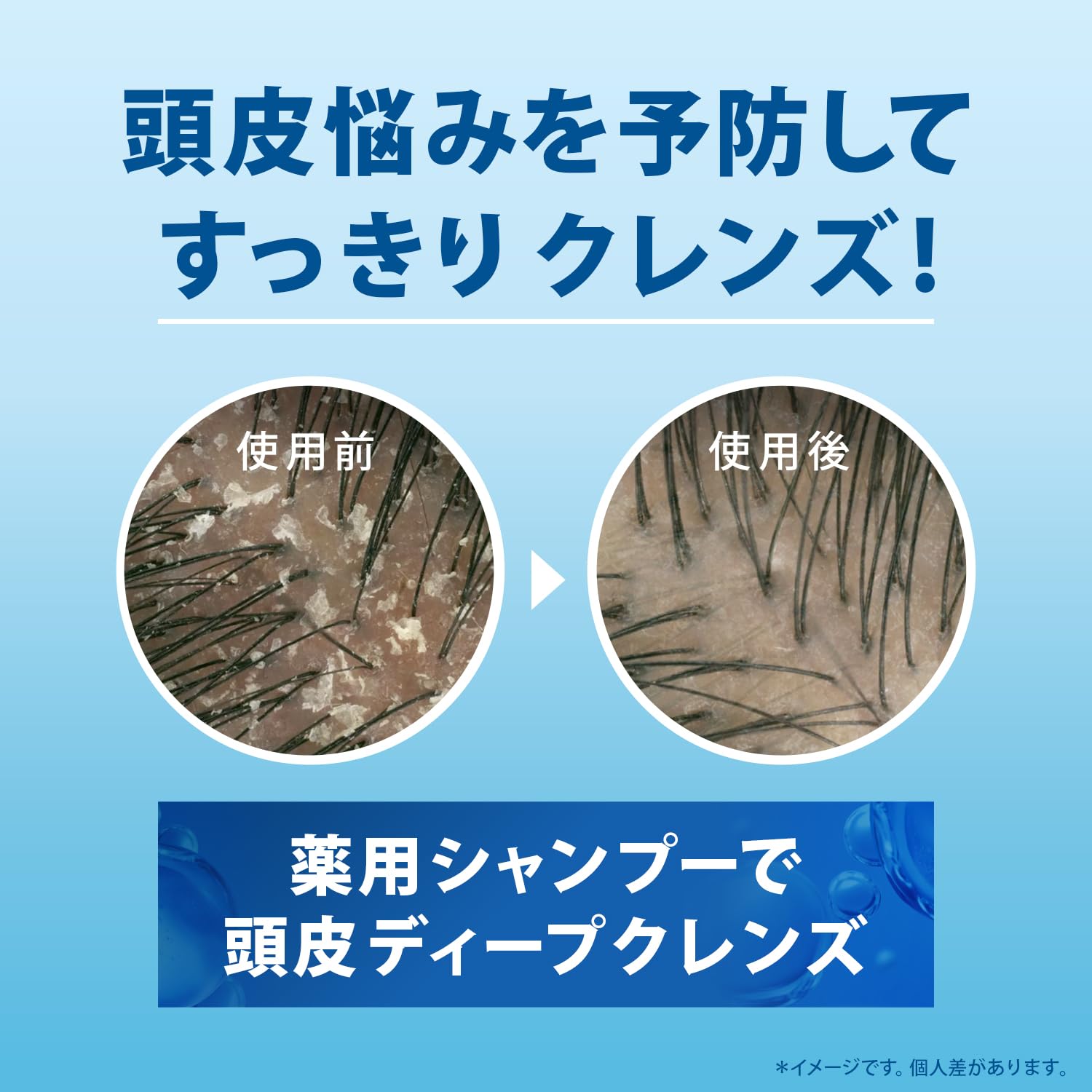 h&s(エイチアンドエス) モイスチャー インテンシブトリートメント180g × 2個 洗い流すトリートメント 地肌の乾燥かゆみフケとパサつく髪に h&s(エイチアンドエス) モイスチャー インテンシブトリートメント180g × 2個 洗い流すトリートメント 地肌の乾燥かゆみフケとパサつく髪に