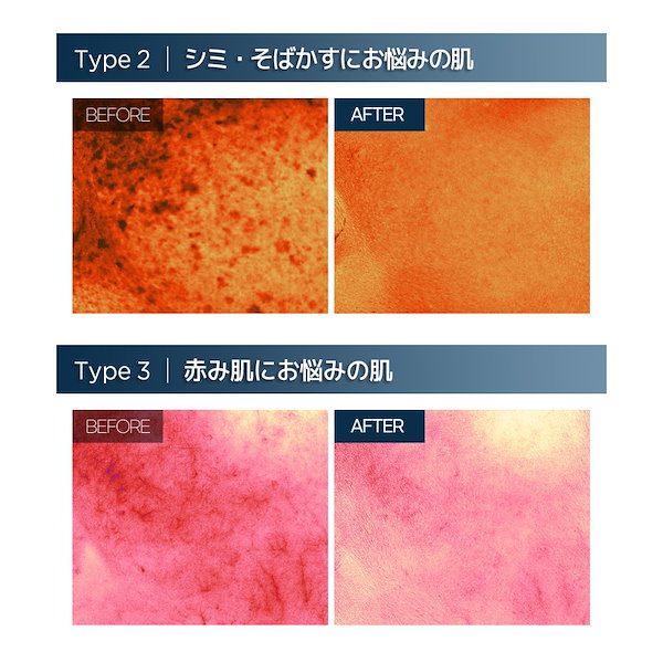 Qoo10] BOM カバー フレックス スキンフィット ファ