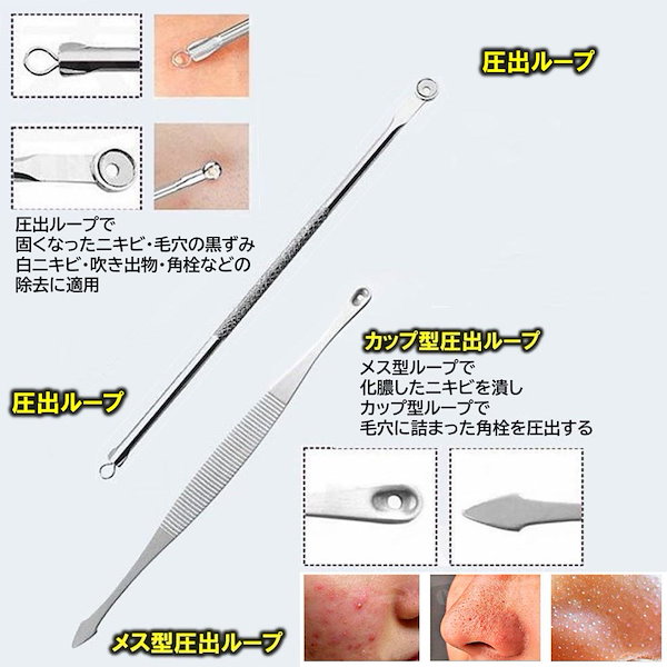 Qoo10] 本セット ニキビ取り ニキビ 除去 毛穴