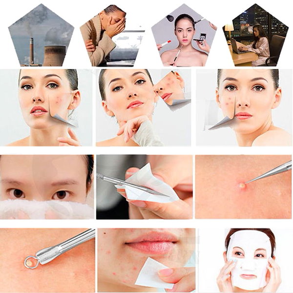 Qoo10] 7本セット ニキビ取り ニキビ 除去 毛