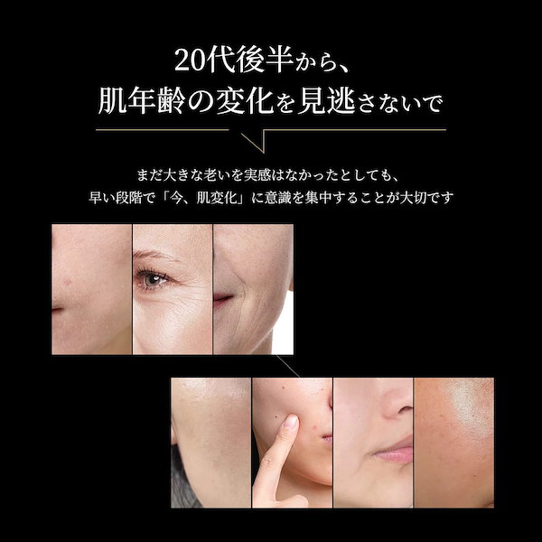 Amazon.co.jp: 【美人百花RF美顔器部門NO1】ANLAN RF温冷美顔器