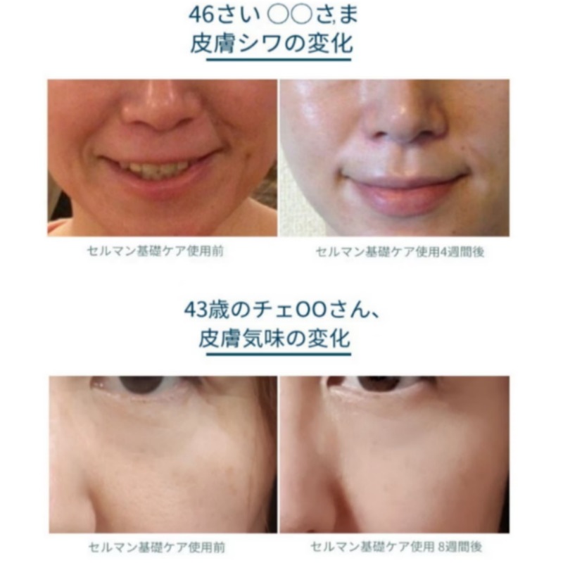 【韓国の美容皮膚科医オススメ！】セルマンプレミアムペプチドクリーム(50ml) mdprevattcaulkingandwaterproofing.com