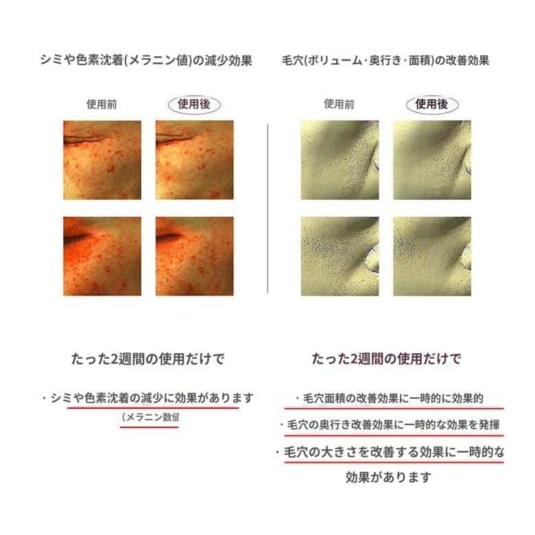 【4ever Line】 キュリペアーメラクリーム 35ml / メラニン / 毛穴 / 色素 / 抑制 / loverセット / あやぱん / メルダーシステム / sos / てんこ / 洗顔 【4ever Line】 キュリペアーメラクリーム 35ml / メラニン / 毛穴 / 色素 / 抑制 / loverセット / あやぱん / メルダーシステム / sos / てんこ / 洗顔