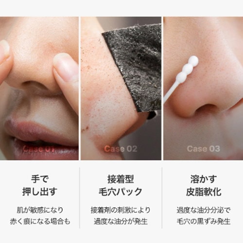 メディキューブ Qoo10] メディキューブ 【公式】ゼロ毛穴ワックス (黒ずみ／角栓
