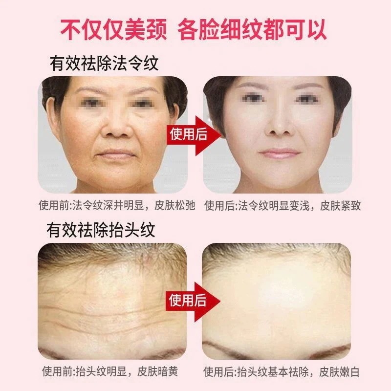 メガ割 首のシワ取り 首の美容器 家庭用 首の美容器 法線 引き締め 首のしわ マッサージ 顔 メガ割 首のシワ取り 首の美容器 家庭用 首の美容器 法線 引き締め 首のしわ マッサージ 顔