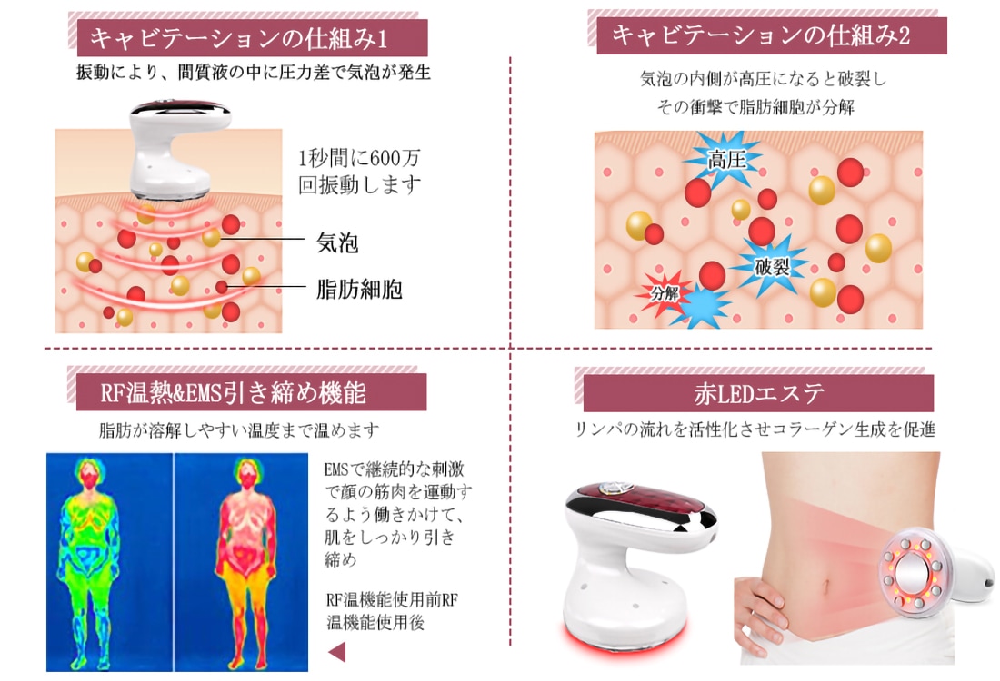 痩身美顔器 家庭用キャビテーション機器 ボディ専用 マッサージ器 振動エステ 赤LEDエステ 美肌 RFラジオ波高周波 振動 全身ダイエット 男女兼用 痩身美顔器 家庭用キャビテーション機器 ボディ専用 マッサージ器 振動エステ 赤LEDエステ 美肌 RFラジオ波高周波 振動 全身ダイエット 男女兼用