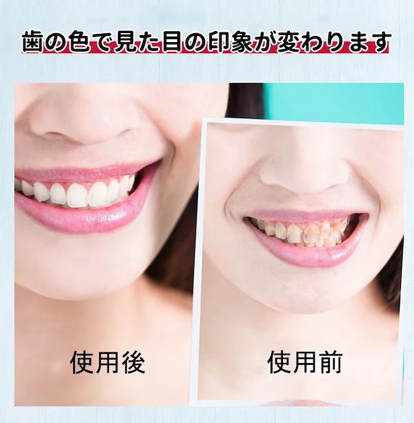 Qoo10] SMILEKIT ホワイトニング 16個ledライト/取扱