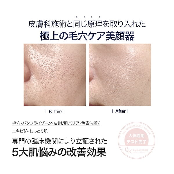 【美品】毛穴特化美顔器　セロラバイ ペンタショット【美容クリニックレベル】 美品】毛穴特化美顔器セロラバイ ペンタショット【美容クリニックレベル】