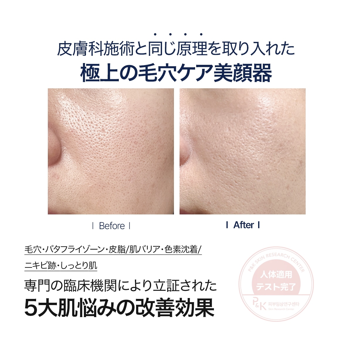 Qoo10] セロラバイ 【毛穴美顔器】ポテンションペンタショット