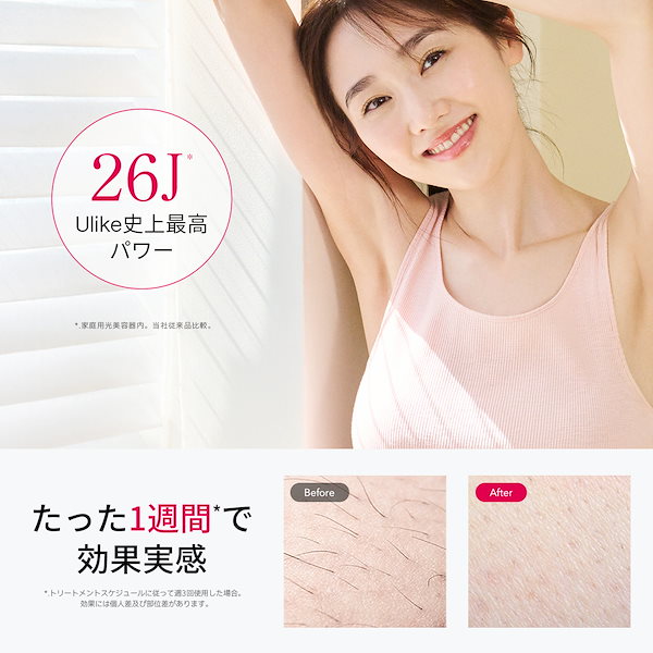 Qoo10] Ulike Air10 光美容器 痛みレス 全身/V