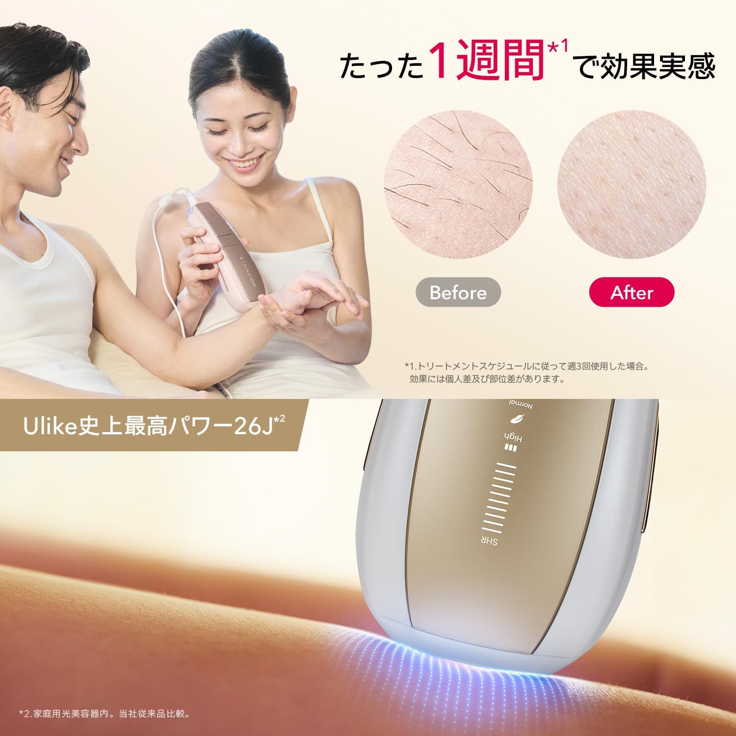 【正規品】Ulike 脱毛器 Air10 光美容器 髭/脇/VIO/脚/腕 Amazon | 【正規品】Ulike 脱毛器 Air10 光美容器 髭/脇/VIO/脚/腕