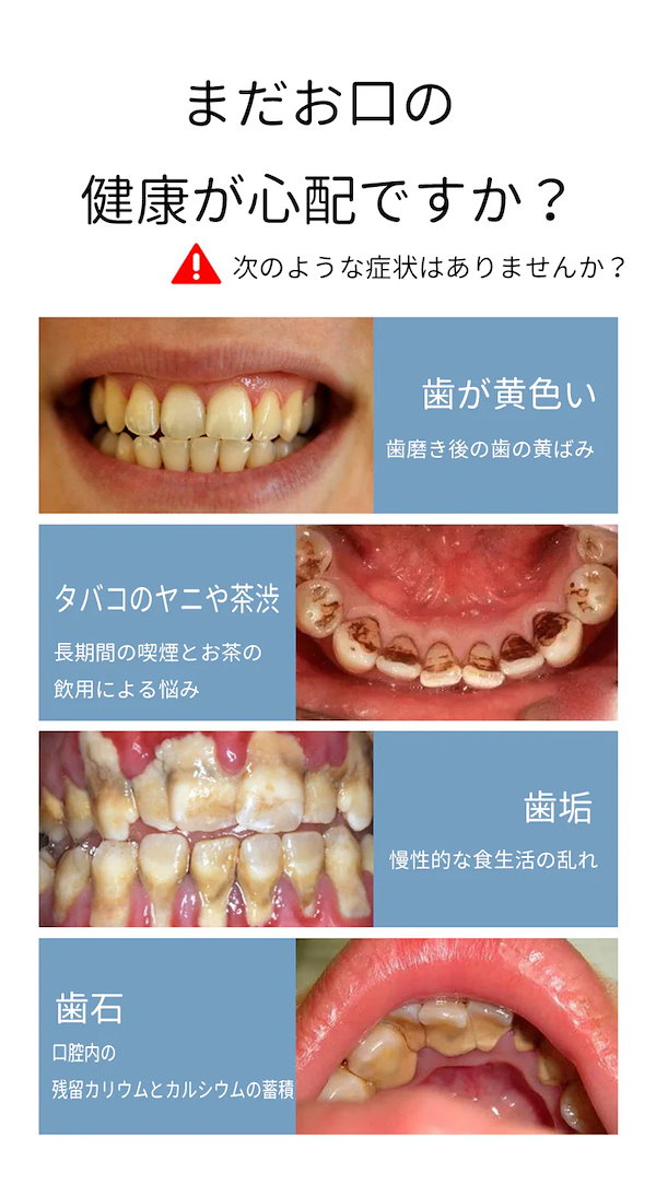 お値段交渉アリ！！歯科衛生士 スケーラー 衛生士 教材 歯