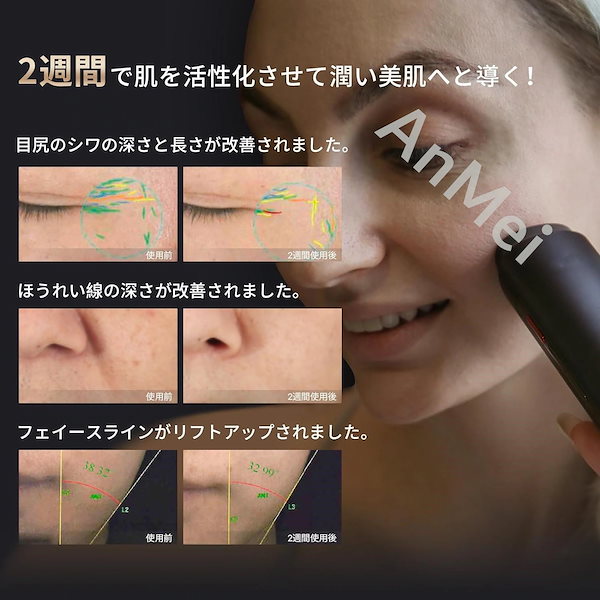 Qoo10] EMS 美顔器 1台10役 ラジオ波 R