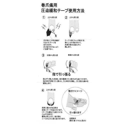 巻爪痛用 圧迫緩和テープ S【10個セット】（母趾用12枚他の指用10枚）足の巻き爪 自分でテーピング 巻きづめ矯正グッズ 形状記憶 巻爪防止 ヒール靴
