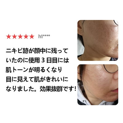 超音波美顔器 Qoo10] Quadthera 【 水玉 超音波 美顔器 】クアッドセラ : 美容