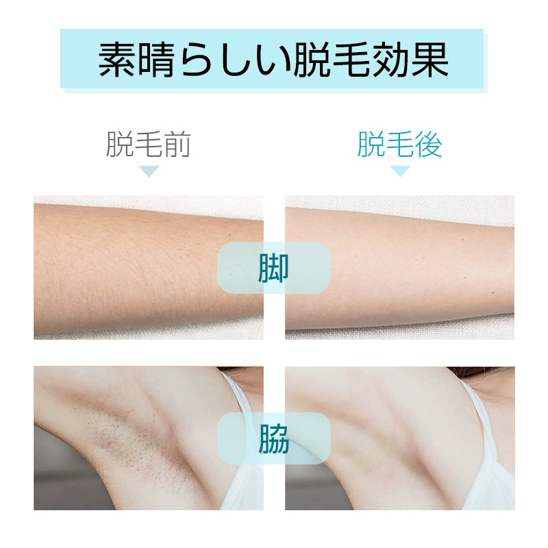 脱毛器 IPL脱毛器 40万回照射 冷感脱毛 冷却機能 5段階調節 手動/自動発光 ２つの照射モード 無痛脱毛 光美容器 男女兼用 口周り ワキ 腕 足 背中 Vライン 全身使用 質量 328.6g_4