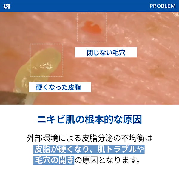 美容液 Rara Amazon | 皺美容液 金糸コラーゲン リフトモイストセラム 毛穴