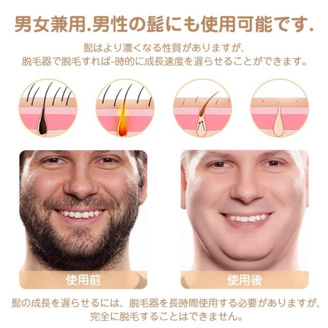 [Q10最安値*即納]最新型 脱毛器 IPL脱毛器 光美容器 ヒゲ ムダ毛処理 vio対応 剛毛 女性 男性 アンダーヘア 全身用 永久脱毛 レーザー 家庭用 1保証 (T4)