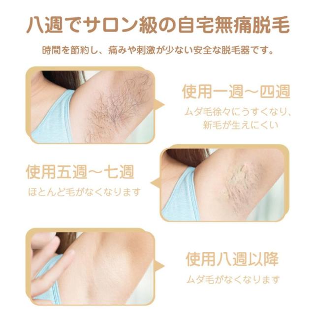 [Q10最安値*即納]最新型 脱毛器 IPL脱毛器 光美容器 ヒゲ ムダ毛処理 vio対応 剛毛 女性 男性 アンダーヘア 全身用 永久脱毛 レーザー 家庭用 1保証 (T4)