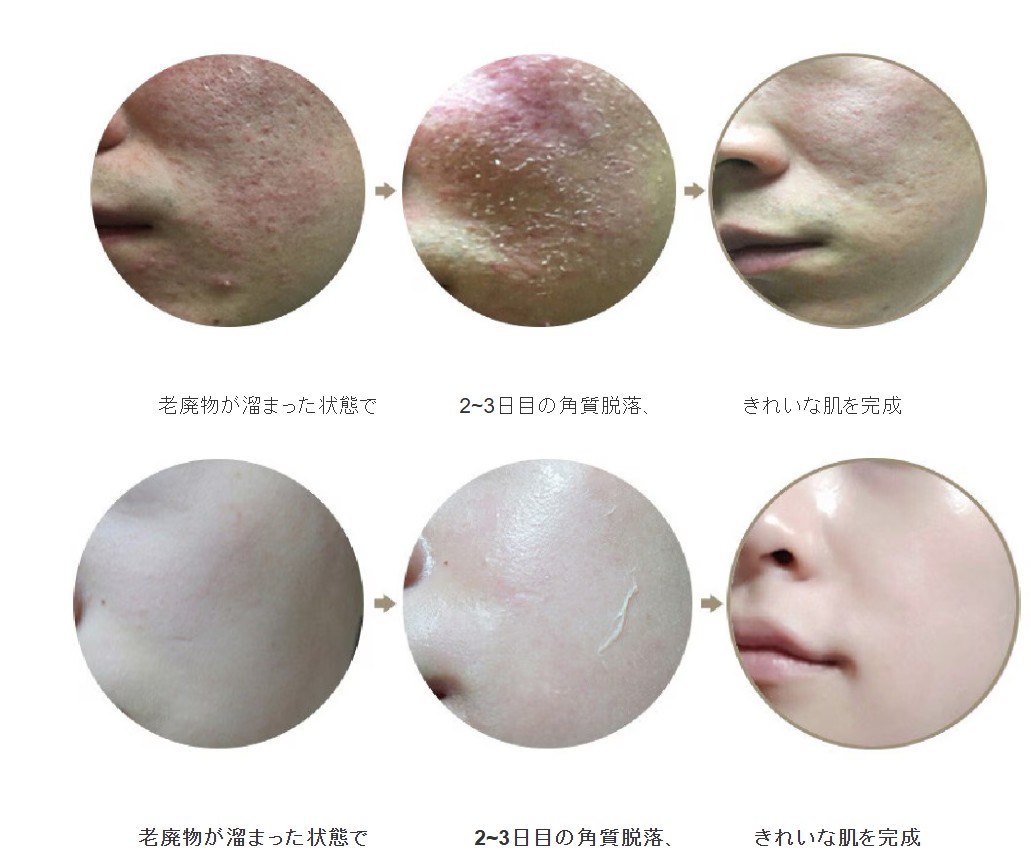 【セット】ピーリング10回分（20g）＋リセルキュアアンプル＋ダブルキュアBBバーム トラブル肌ケア用