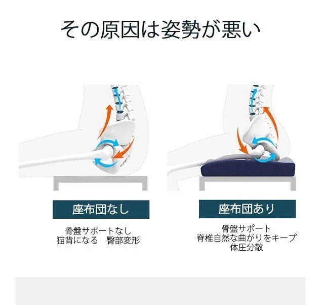 団体購入(10個)丸型 円座クッション 高反発 産後 痔 姿勢矯正 骨盤矯正 オフィス ドーナツ クッション 腰痛 尾146 団体購入(10個)丸型 円座クッション 高反発 産後 痔 姿勢矯正 骨盤矯正 オフィス ドーナツ クッション 腰痛 尾146