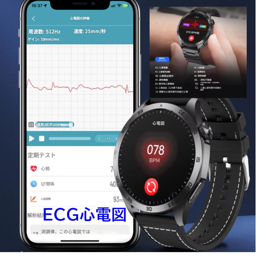 スマートウォッチ ET485 ECG心電図 血糖値 体脂肪BMI 尿酸血中脂質 血中酸素 血圧測定 心拍数 呼吸率 体温 血液分析 月経周期 通話機能 着信通知 音楽 睡眠管理 防水 日本語 腕時計