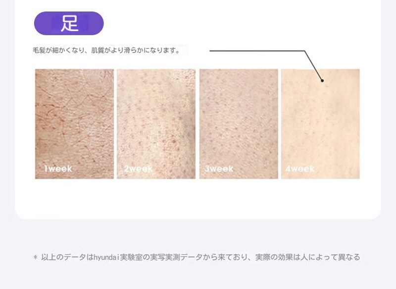 脱毛器光美容器 最新モデル 顔 ワキ vio アンダーヘア メンズ レディース 冷却機能 低刺激 軽い 男女兼用 脱毛器 美肌ケア ランキング 脱毛器光美容器 最新モデル 顔 ワキ vio アンダーヘア メンズ レディース 冷却機能 低刺激 軽い 男女兼用 脱毛器 美肌ケア ランキング