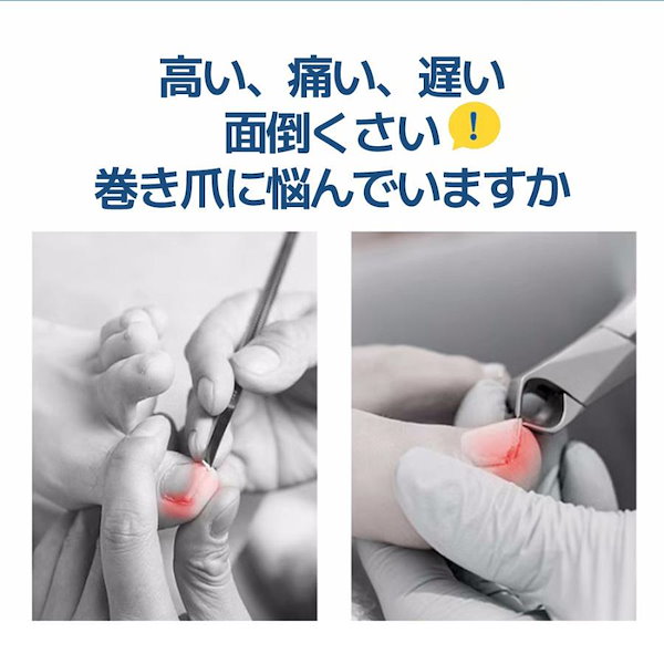 Qoo10] 2個セット 巻き爪 矯正 器具 マキちゃ