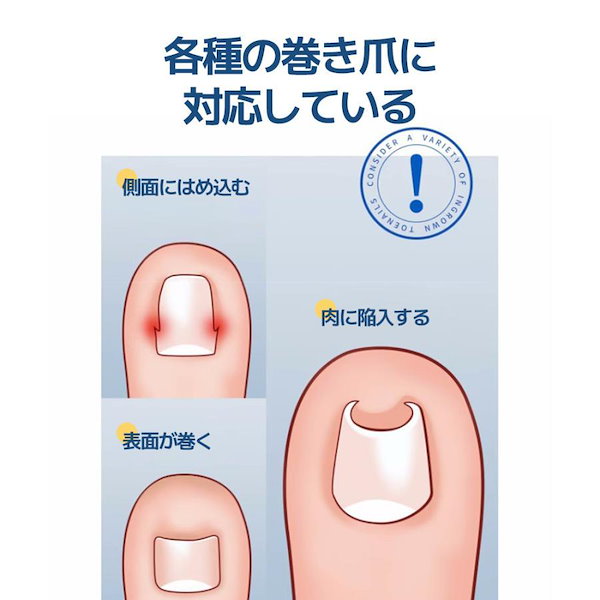 Qoo10] 2個セット 巻き爪 矯正 器具 マキちゃ