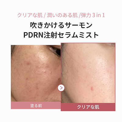 Qoo10] メディキューブ 【11月1日~3日 発売記念ポッキリ