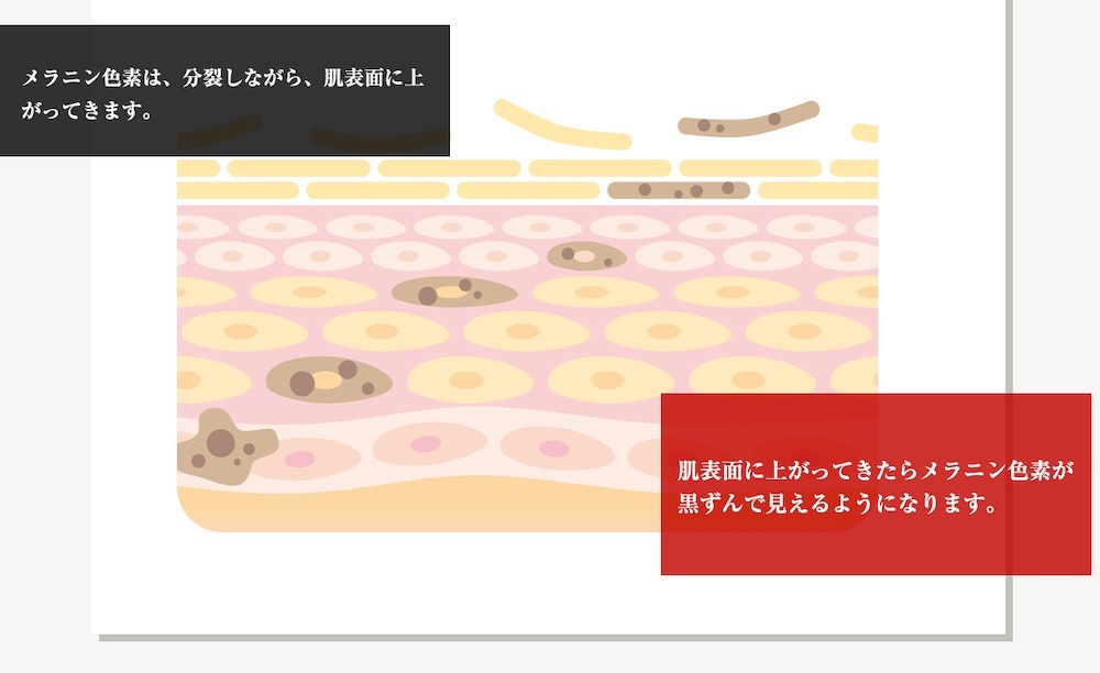 即納 デリケートゾーンの黒ずみ対策クリーム Be89 2本セット医薬部外品美白クリーム 30g 乳首 マタニティー 乳頭 バスト 黒づみ くろずみ 毛穴 ケア ボディクリーム レディース お尻