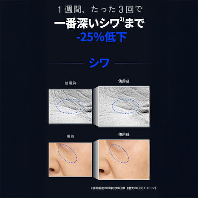 IOPE - 【確認用】 v6プラス「固定IPサービス」 設定ガイド : UNIVERGE IXシリーズ